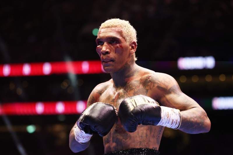 Eddie Hearn questions whether Conor Benn is a ‘compulsive liar’