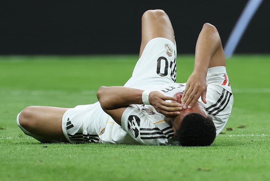 Mbappé suffers head cut, skips training before Real decider