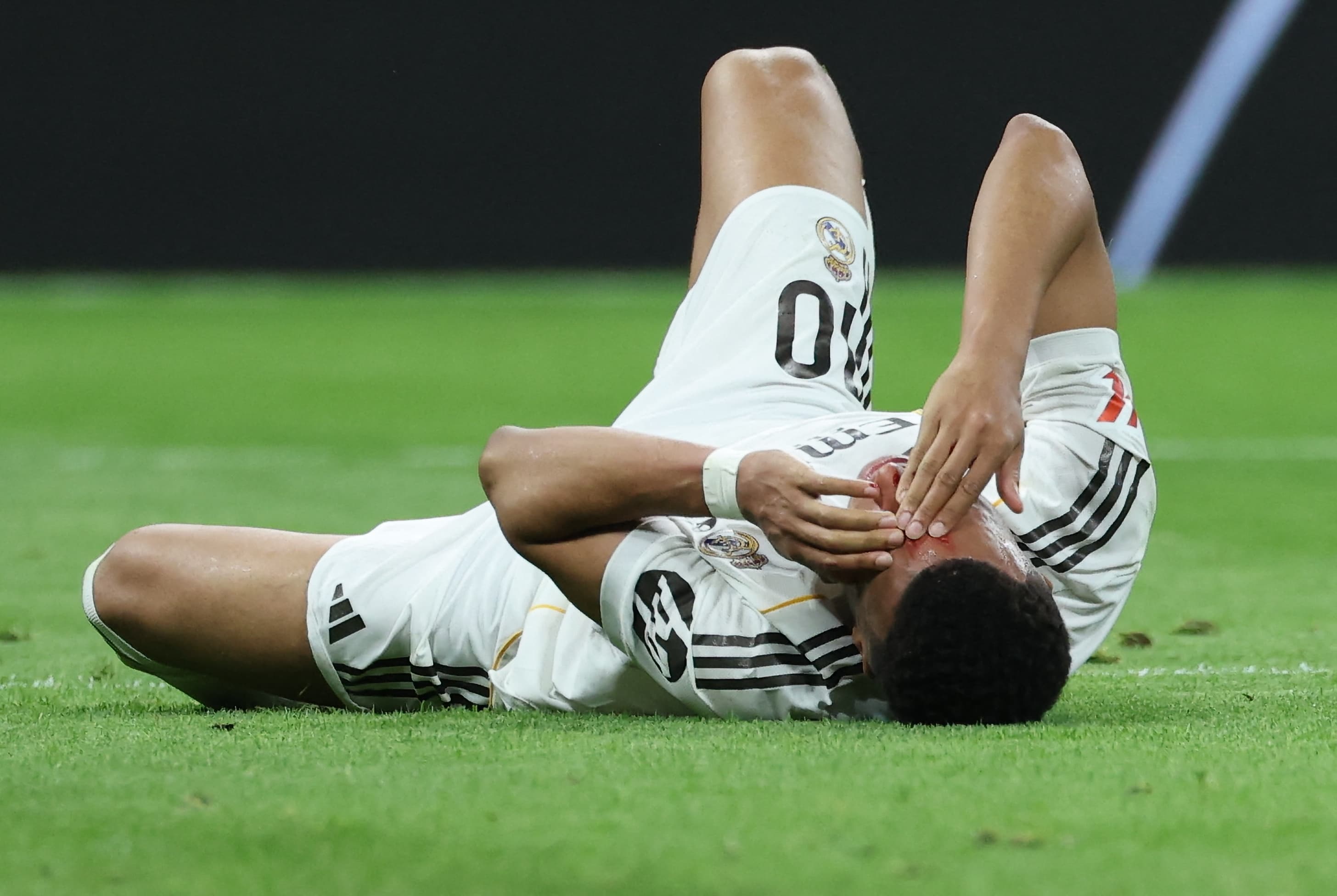🤕 Mbappé, bloodied head! Arbeloa furious: Penalty here and on the moon 🤬