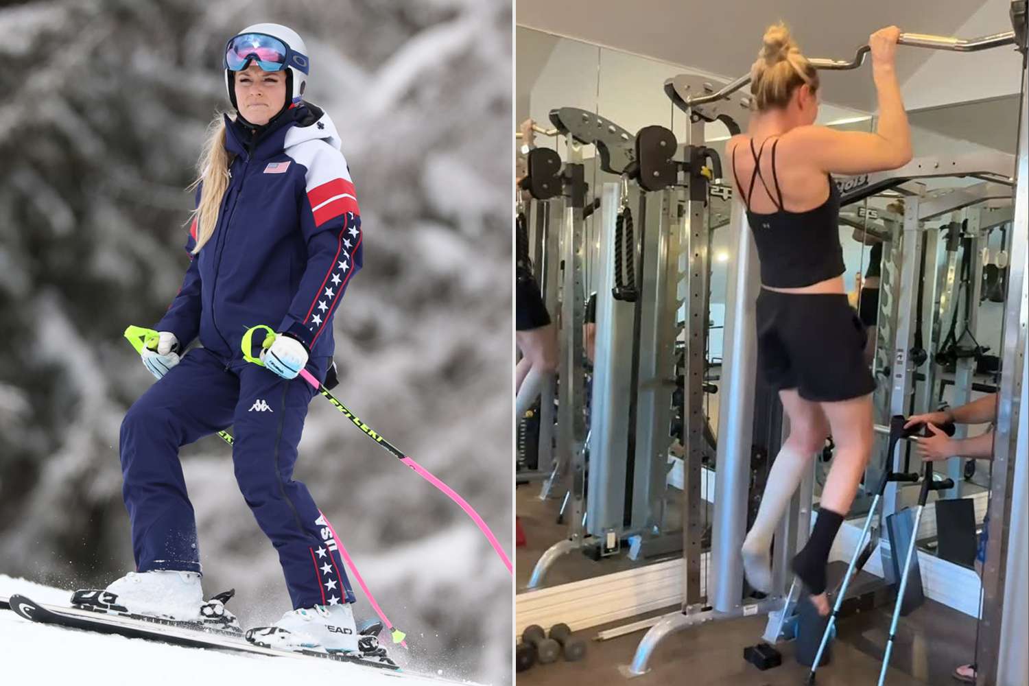 Lindsey Vonn Shows off Incredible Gym Progress 5 Weeks After Horrific Olympics Crash