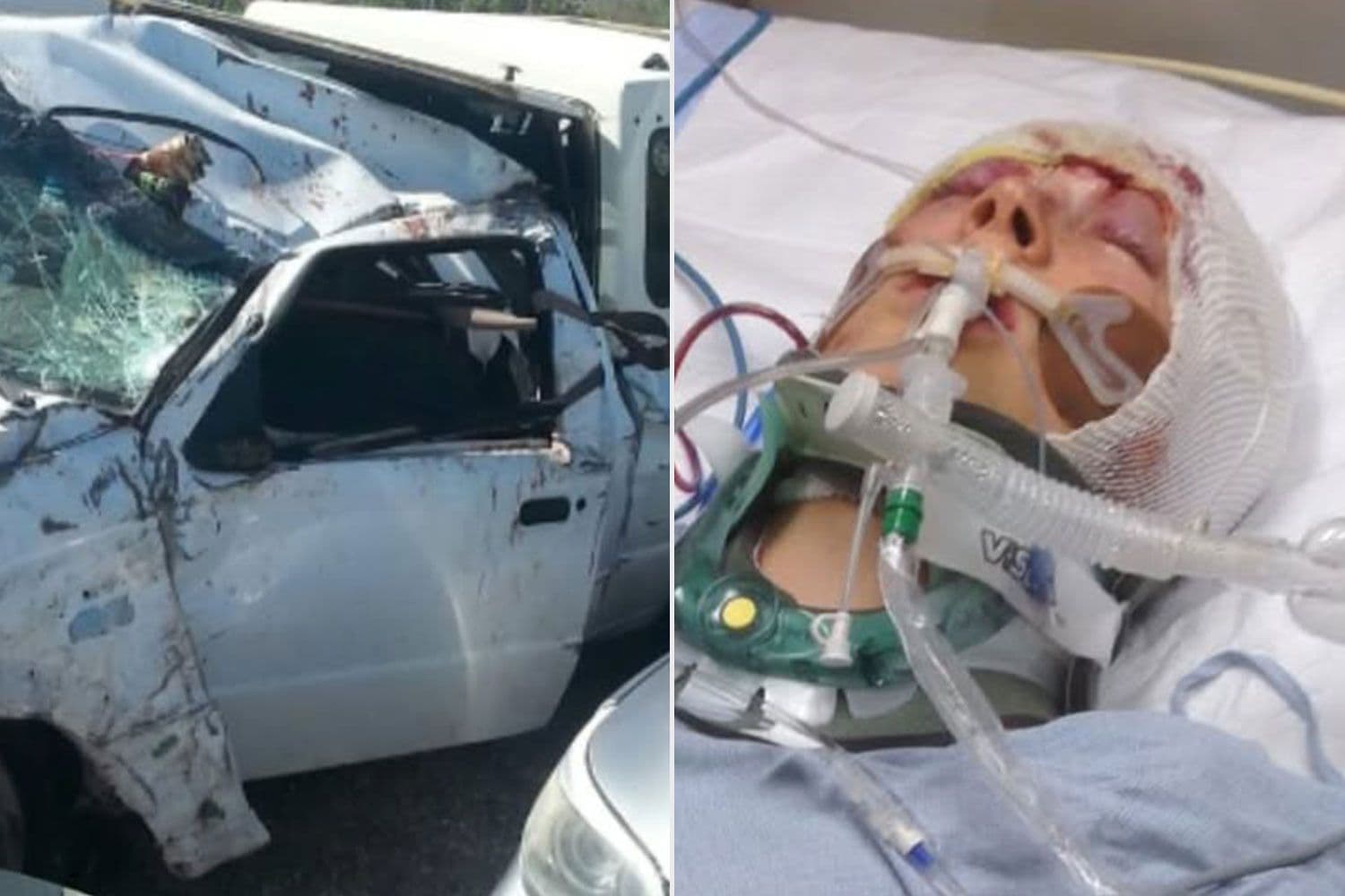 Olympic Skier Colby Stevenson Celebrates 10-Year 'Rebirth' After He 'Shattered Skull' in Near-Death Accident
