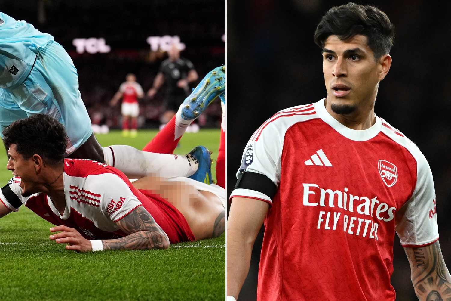 Professional Soccer Player Goes Viral for On-Field Wardrobe Malfunction That Leaves His Butt Cheeks Exposed