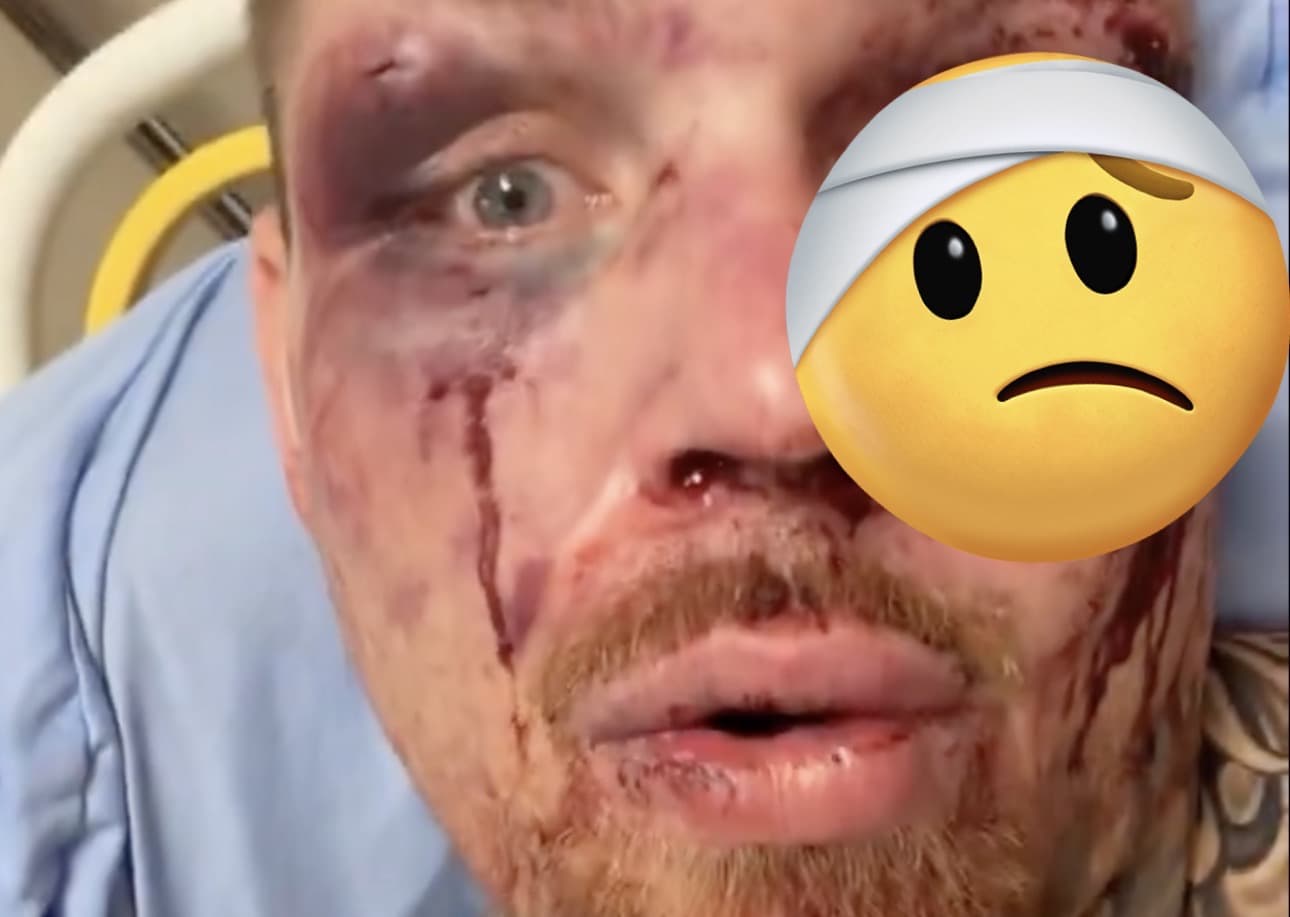 Stunning Blow: Steven Asplund Dominates Challengers in Electric Las Vegas Showdown!