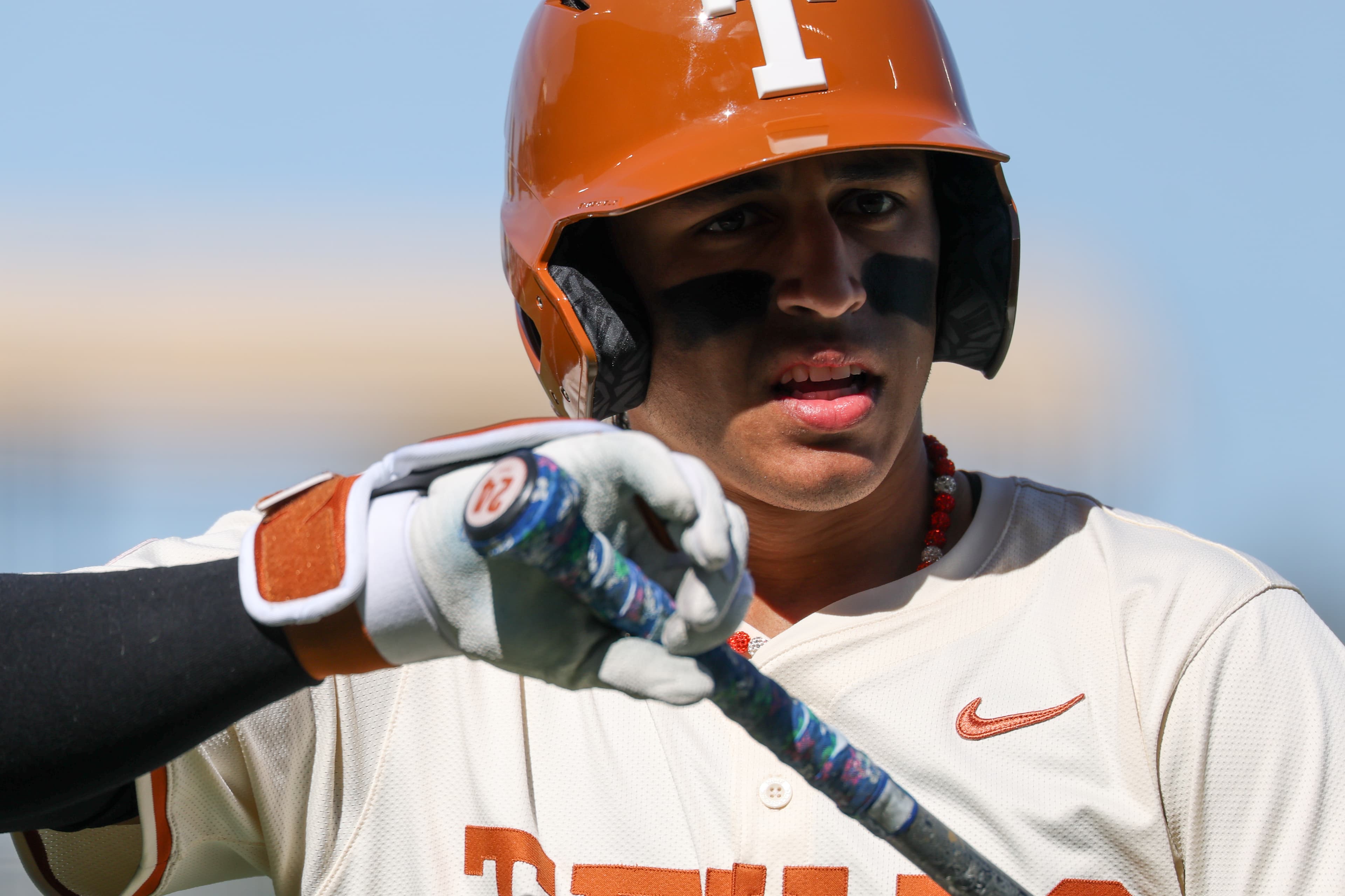 Why Texas SS Adrian Rodriguez needed another hand surgery