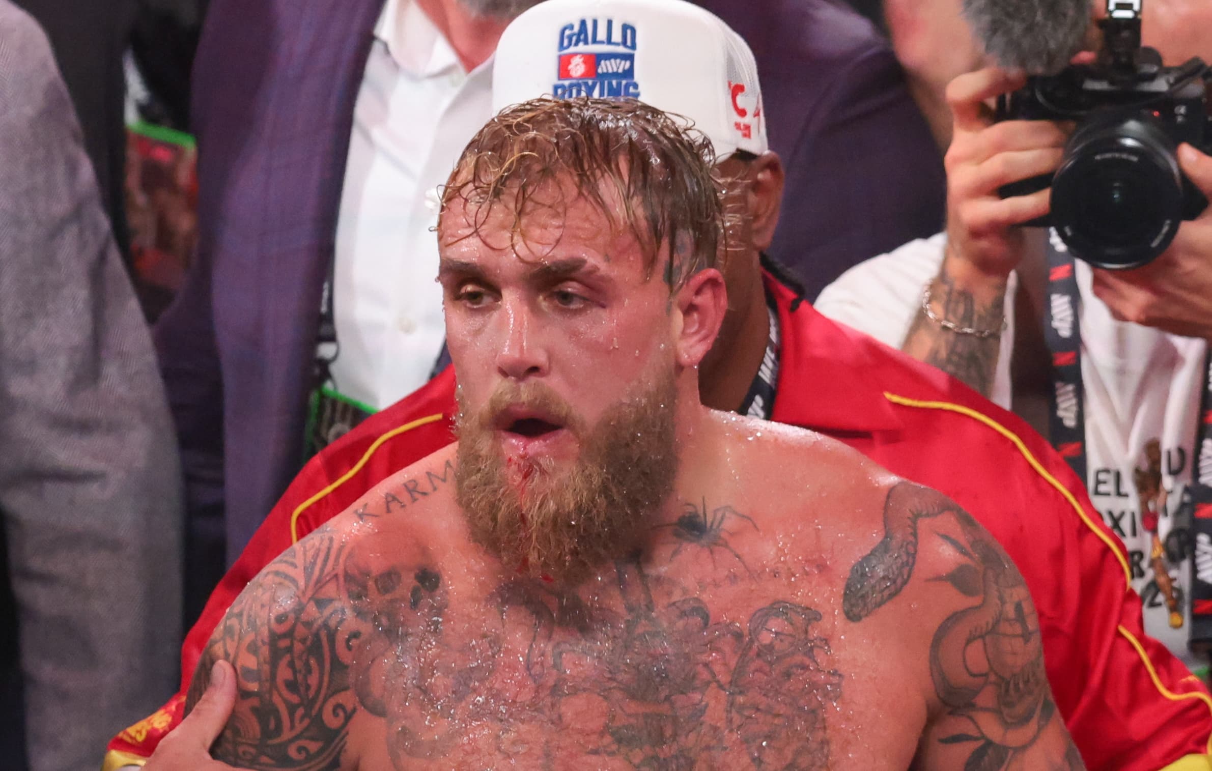 Jake Paul confirms boxing career could be over after broken jaw