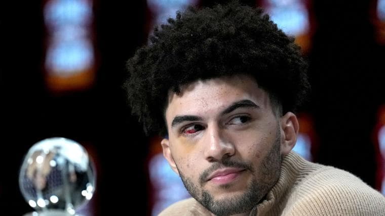 Duke's Cameron Boozer dealing with unfortunate injury after UConn loss