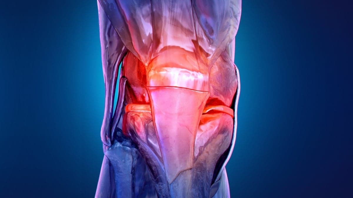 Emerging Osteoarthritis Treatment Involves Electrically Stimulating Muscles